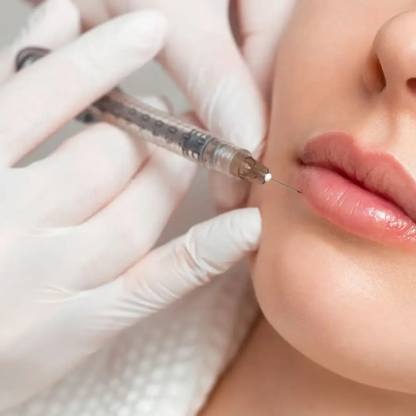 Lippenaufspritzung